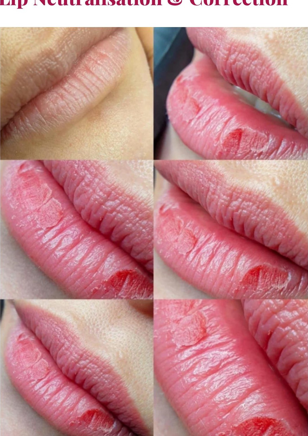 Lip neutralisation examples from the Jealash Academy training manual