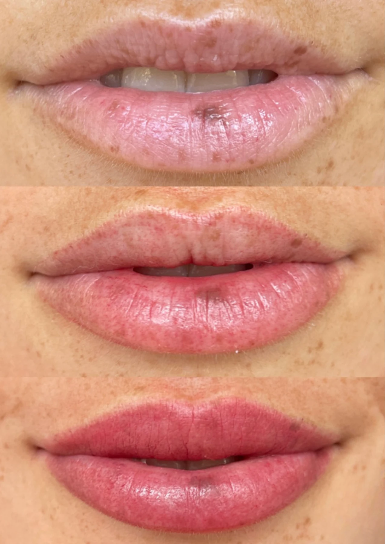 Lip blush result sequence with soft rosy finish