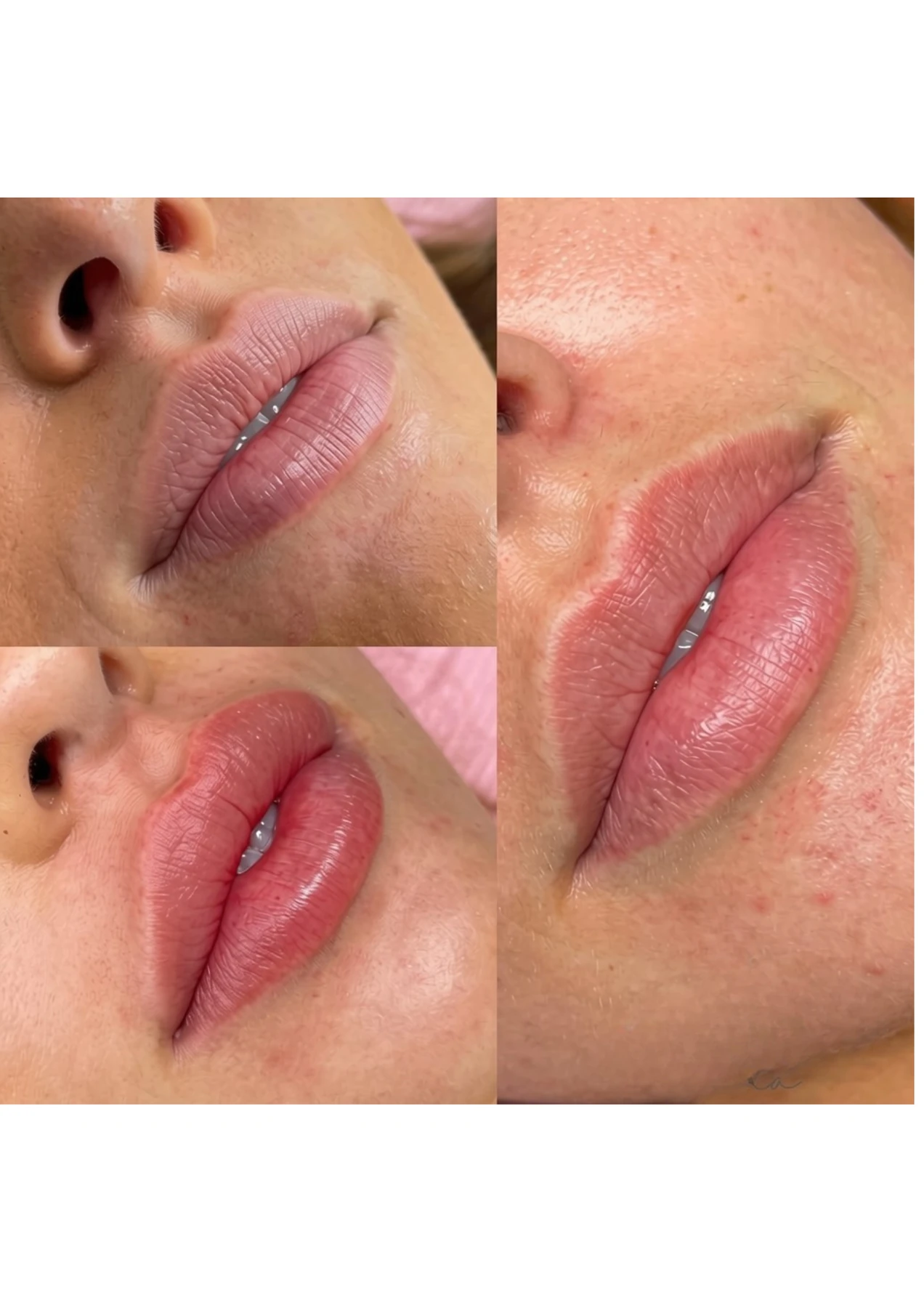 Lip blush result shown from several angles