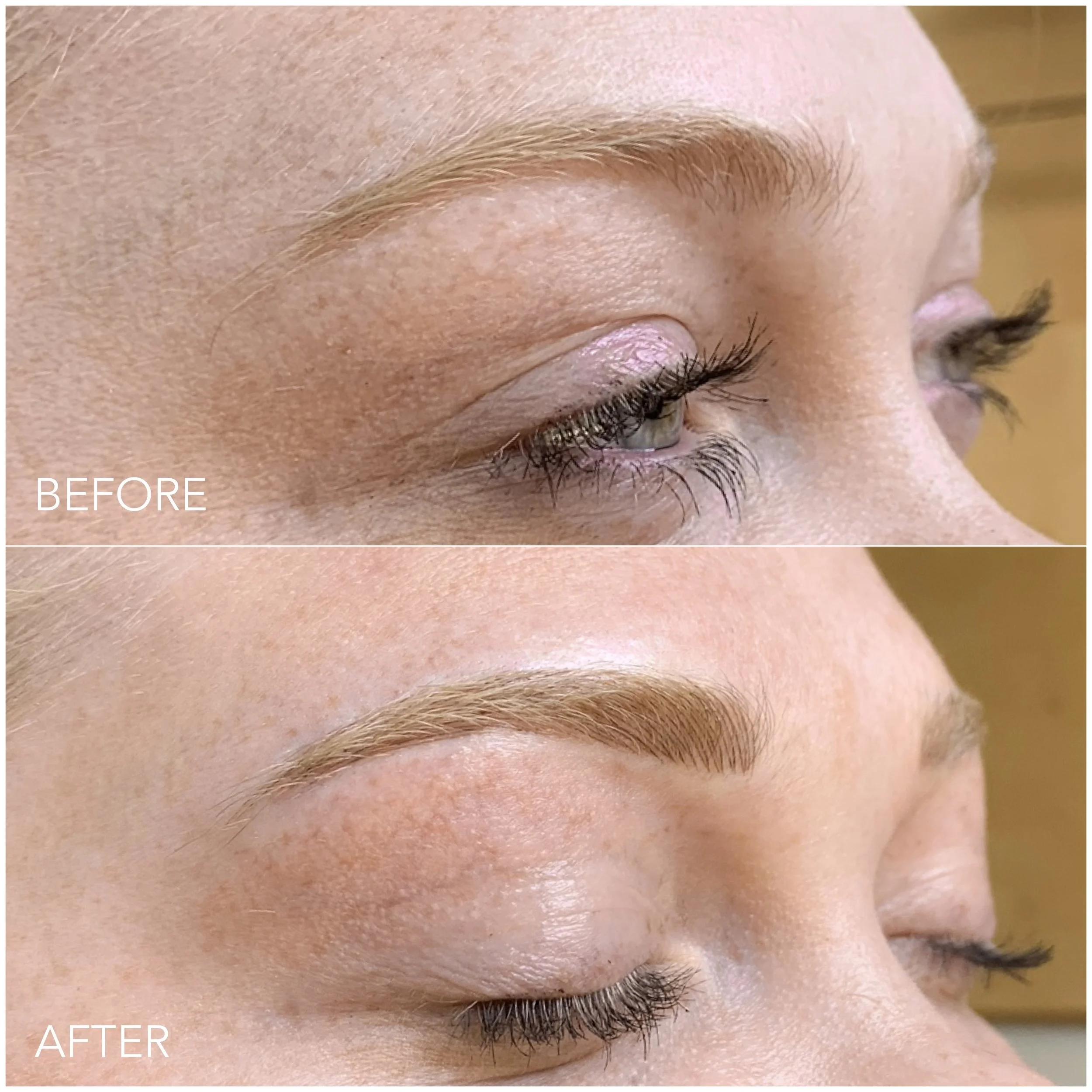 Brow transformation before and after